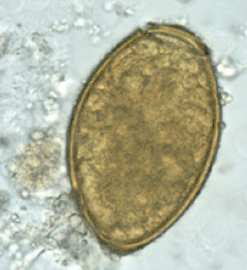 Image: Egg of Paragonimus westermani (Photo courtesy of US Center of Disease Control and Prevention).